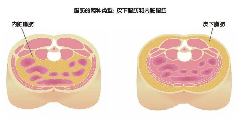 征服“啤酒肚”与“游泳圈”